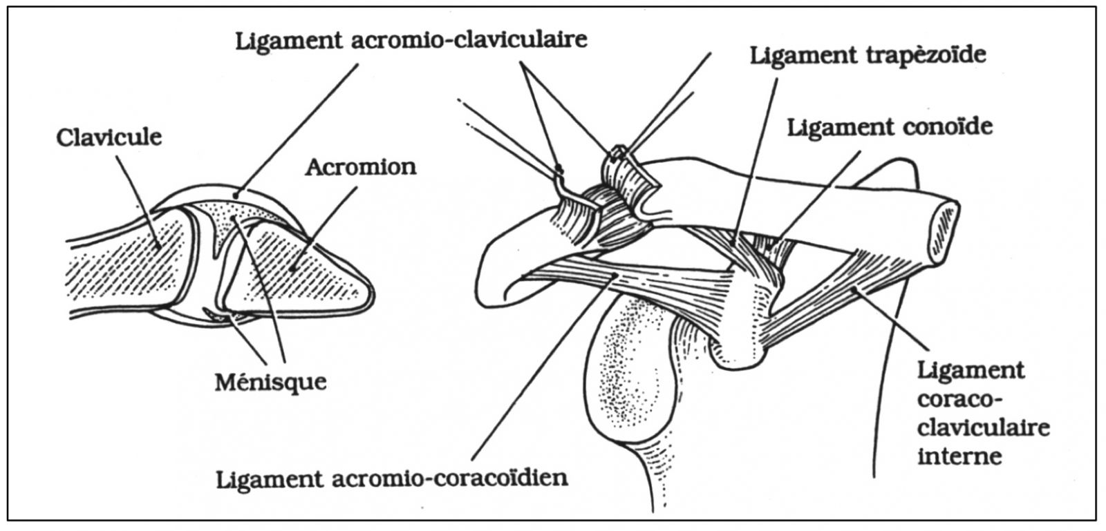 Disjonctions acromio-claviculaires