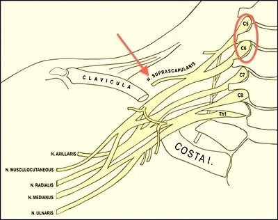 Image du nerf supra scapulaire Centre de l'épaule à Bordeaux