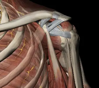 Image ligaments acromio claviculaires Centre de l'épaule à Bordeaux